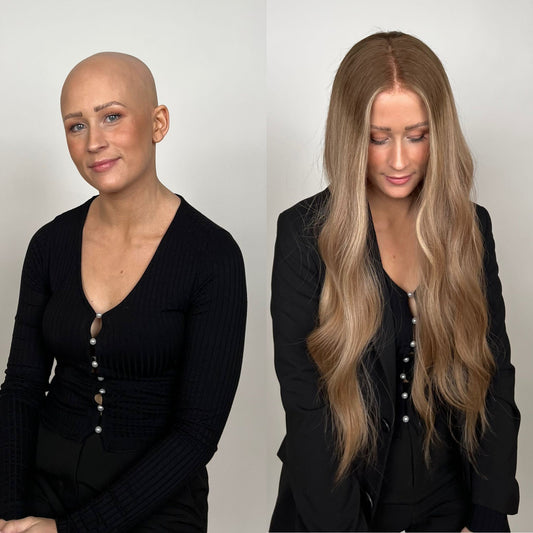 Alopecia girl with our wig and without hair